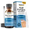 Toenail Fungus Treatment, Nail Fungus Treatment for Toenail Fungus, Nail Treatment for Discolored and Damaged Nails