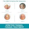 Nail Fungus Treatment for Toenail, 32 Pcs Toe Nail Fungus Treatment Extra Strength for Restores Appearance of Discolored or Damaged Nails